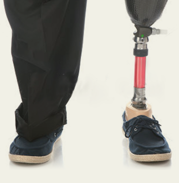 A persons legs from the knee down. One pant leg is pulled up to reveal a below-knee prosthesis.